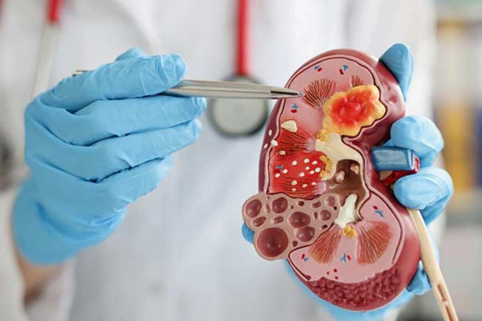 Nephrology